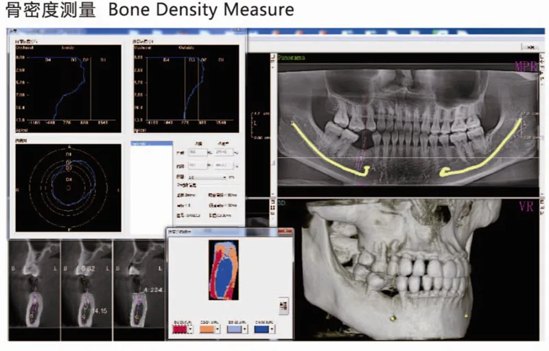 Meyer Digital Dental Panoramic Xray/digital Dental Intraoral Ct Buy