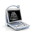 Ergonomic Digital Mindray DP20 Price / Summer Sale!! Portable 12.1 Inch LED Black & White Ultrasound