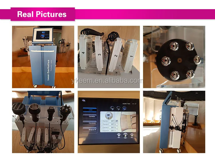 ultrasonic cavitation at home
.jpg