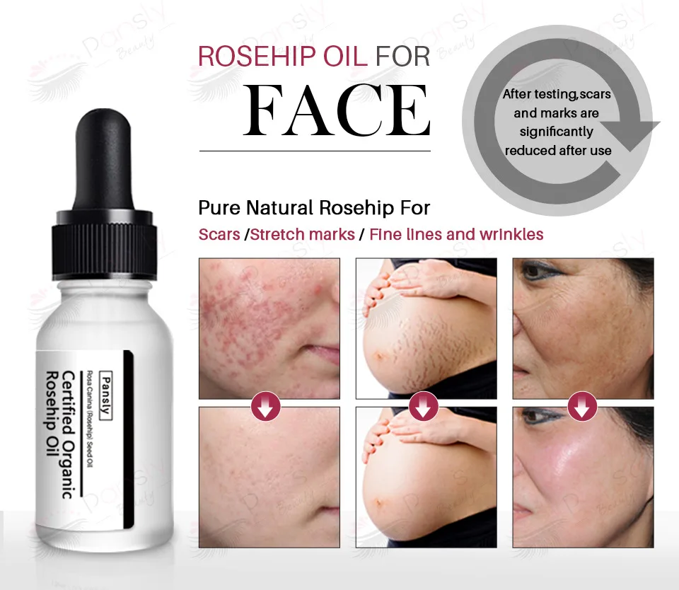 stretch mark oil (6).jpg