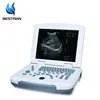 /product-detail/bt-ud500-ce-iso-high-quality-cheap-price-medical-mini-handle-tablet-laptop-ultrasound-scanner-machine-portable-for-women-60724916713.html