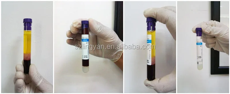 ACD+GEL.2_.jpg