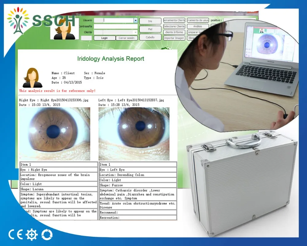 12 Mp Usb Digital Eye Iriscope Iridology Camera Eye Analyzer Machine