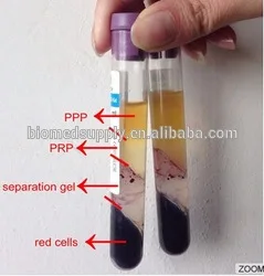 tube centrifugal separator prp centrifuge