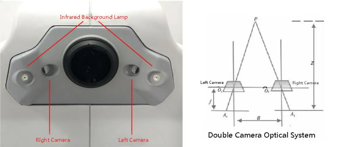 Non-mydriatic Automated Fundus Camera With Fluorescein Angiography