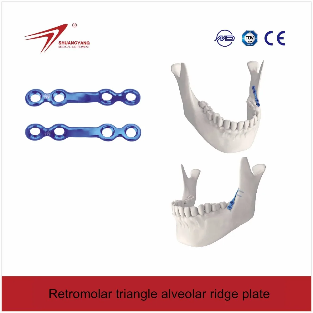 Maxillofacial Medical Titanium Locking Plates,Mini Implant Buy