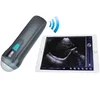 /product-detail/hot-wireless-mini-ios-ultrasound-equipment-ultrasound-b-scanner-uprobe-1-62189817825.html