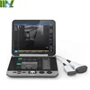 /product-detail/china-manufacturer-portable-mini-ultrasound-laptop-ultrasound-machine-price-60570459380.html