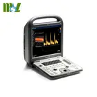 High performance 4D Sonoscape portable color doppler ultrasound scanner S6
