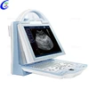 /product-detail/vet-ultrasound-veterinary-ultrasound-portable-veterinary-ultrasound-equipment-60356862429.html