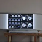 Ray X-ray Viewer Medical X-ray Viewer/ Medical X Ray Equipment ISO2008:9001