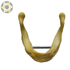 Oral teaching model of implant mandible dental teaching model