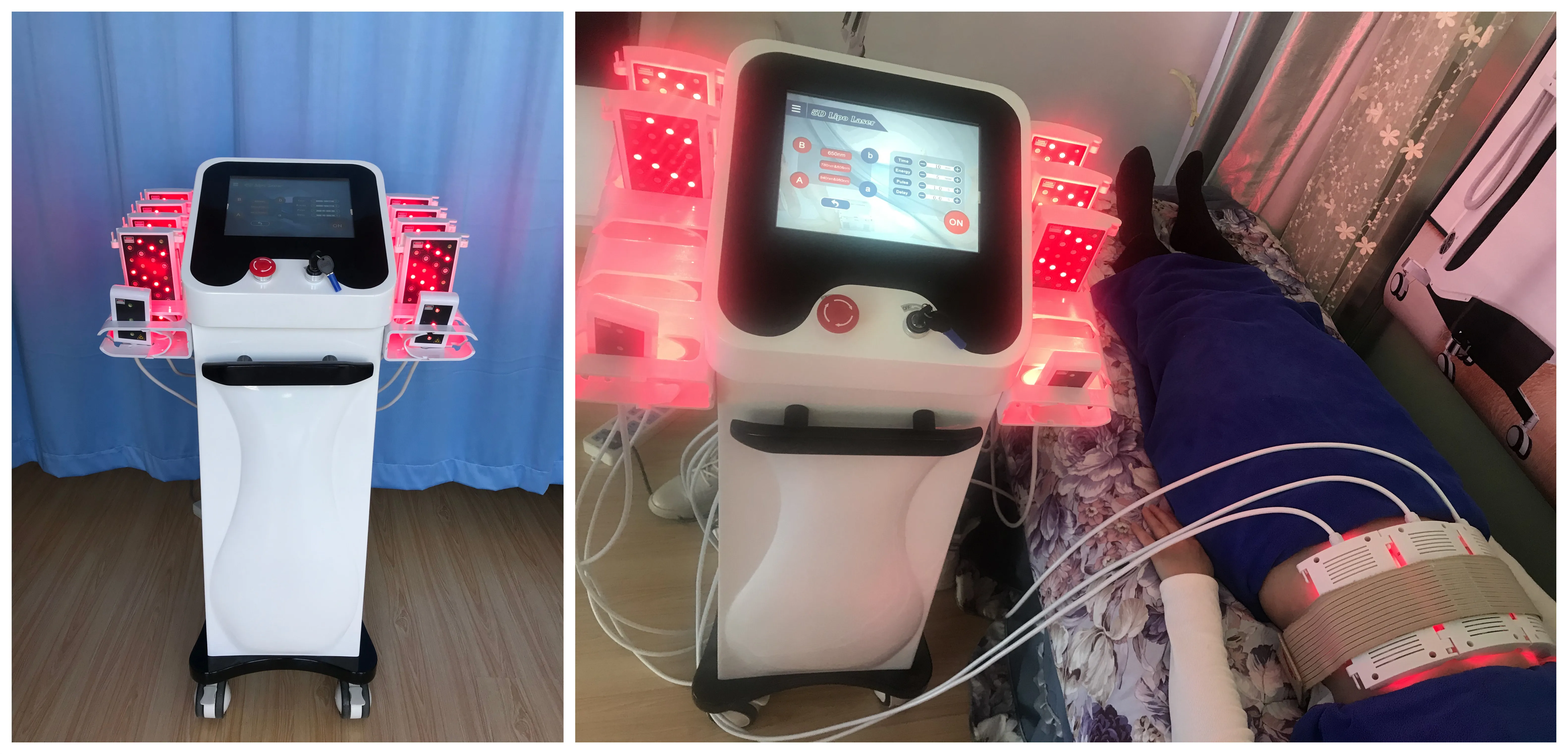 laserlipo.jpg