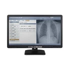 Full HD 30Inch Led TV Display Panel 3280*2048 Lcd Monitor