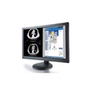 Medical diagnostic displays color display lcd screen