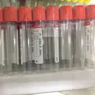Blood Tubes The Latest Type Of Blood Collector Blood Sample Collection Tubes Blood Collection