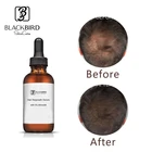 Private Label Natural Organic Anti Hair Loss Care Hair Regrowth Product Fast Hair Growth Serum For Women Men