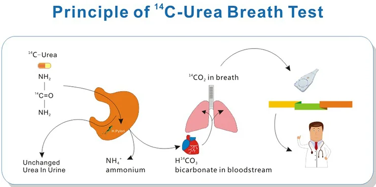H Pylori Infection Carbon14 Urea Breath Test Analyzer Hubt 20a1