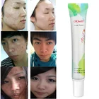 Strong Effect Remove Freckle Melasma Acne Spots pigment Melanin Face Care acne and freckle cream