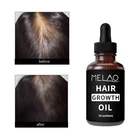 Oil Hair Herbal Hair Private Label Essential Oil Hair Natural Herbal Hair Growth Oil 30ml