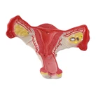 Medical teaching reproductive system female uterus ovary model