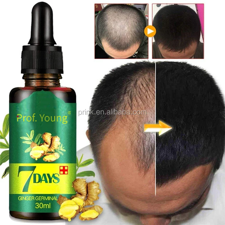 strong hair suitable for receding hairline   -  .