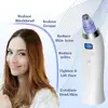 Mini Handheld Facial Pore Blackhead Vacuum Suction Black Head Remover and Acne Cleanser