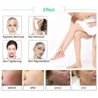 Best Elight Shr Ipl Machine Hair Removal