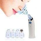 Nose Pore Tool Pimple Blackhead Suction Remover Extractor Review Best Vacuum