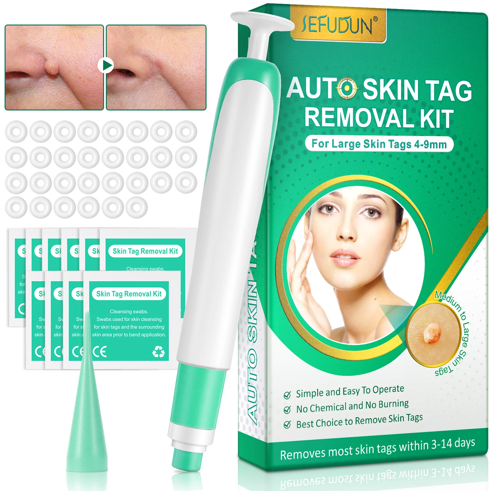 Sefudun Face Skin Body Wart Dot Treatment Remover Plantar Warts Corn