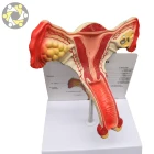 New design Pathological anatomical female system model of uterus teaching