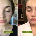Customized Service Best Tea Tree Oil Control Acne Cream Moisturizing Whitening Cream