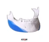 Silicone Implant for Cosmetic Surgery- FITME Mandible