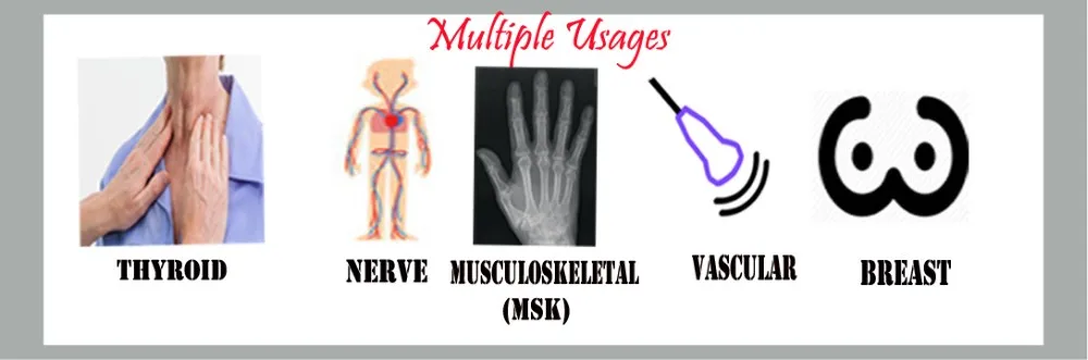 SIFULTRAS-5 Linear Probe ultrasound Scanner-2.jpg