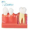 High quality teaching human oral model dental unit dental product for dentist