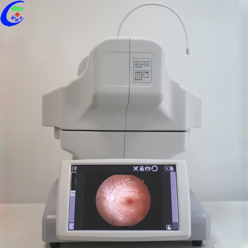 nonmydriatic fundus camera