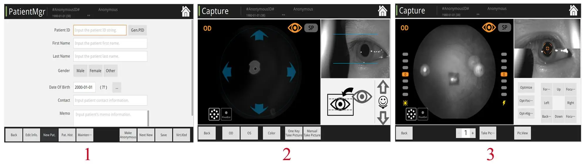 Non-mydriatic Automated Fundus Camera With Fluorescein Angiography