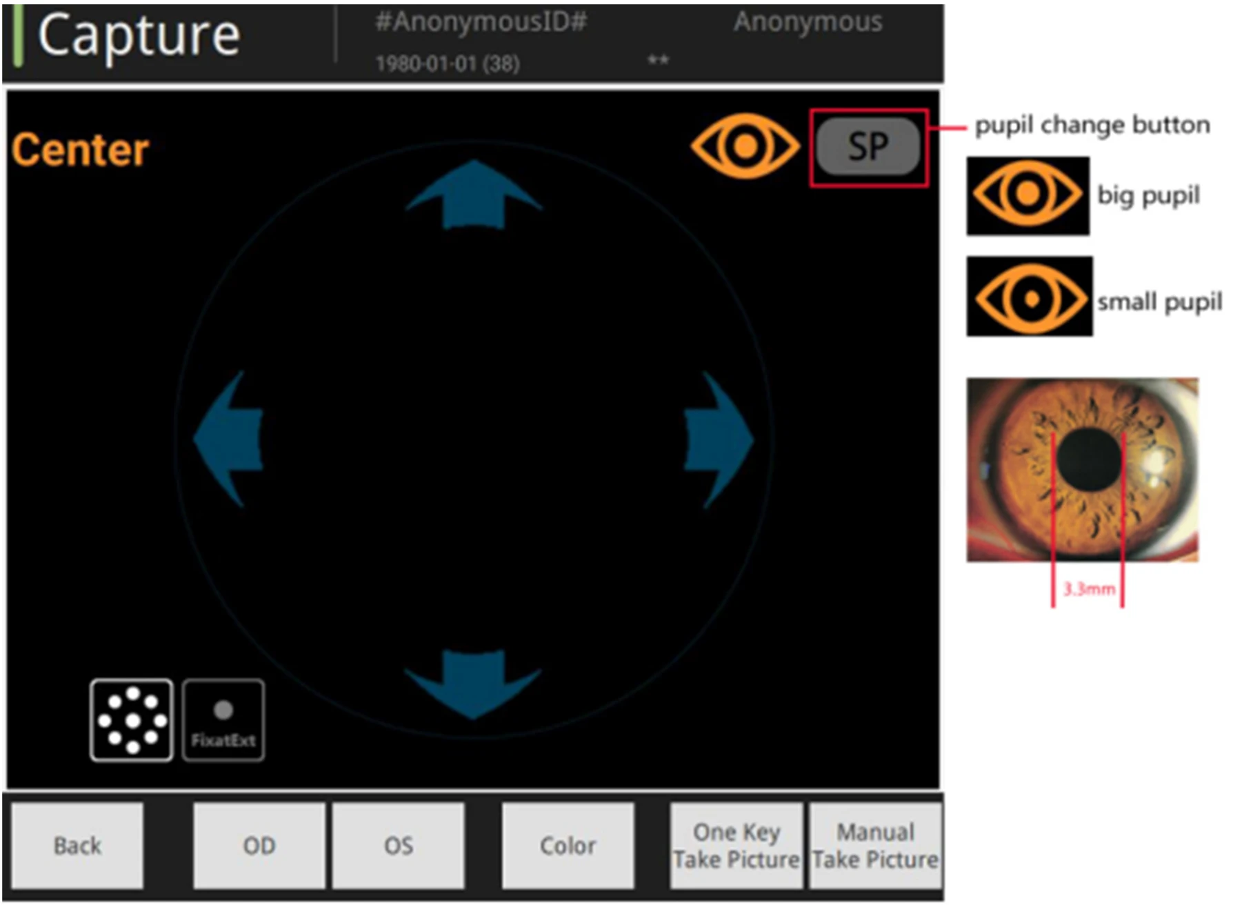 Non-mydriatic Automated Fundus Camera With Fluorescein Angiography