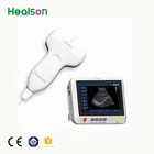 linear array sonosite laptop ultrasound portable android probe