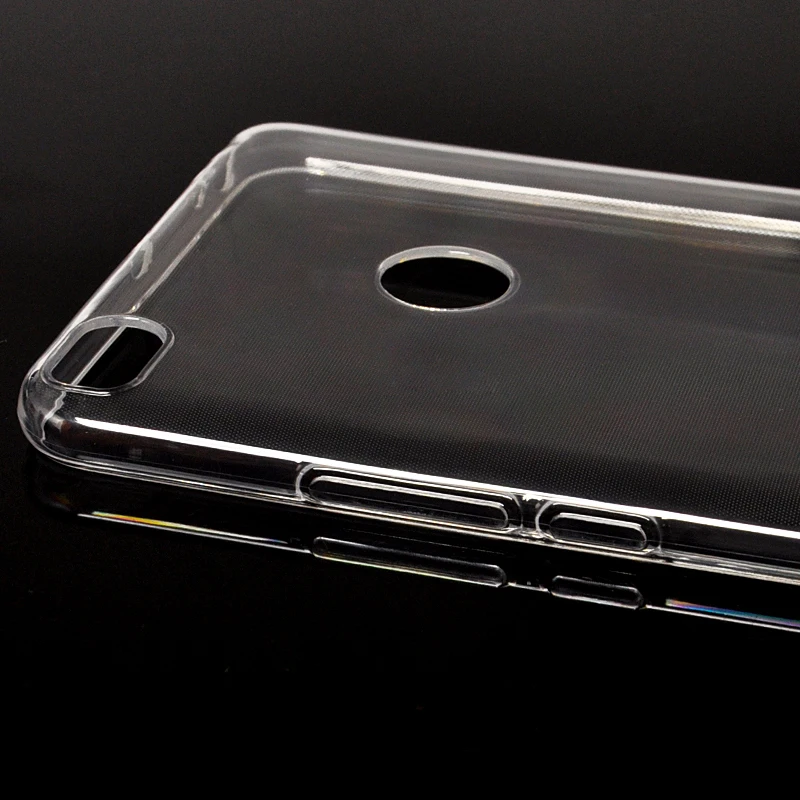 xiaomi max 2 mi max 2 cover case (4)