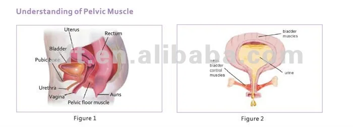 Kegel Exerciser And Muscle Stimulator For Women To Strengthen Pelvic Floor Buy Urge Incontinence Treatment Kegel Exerciser And Muscle