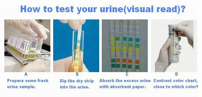 Bayer Urine Test Strips Color Chart