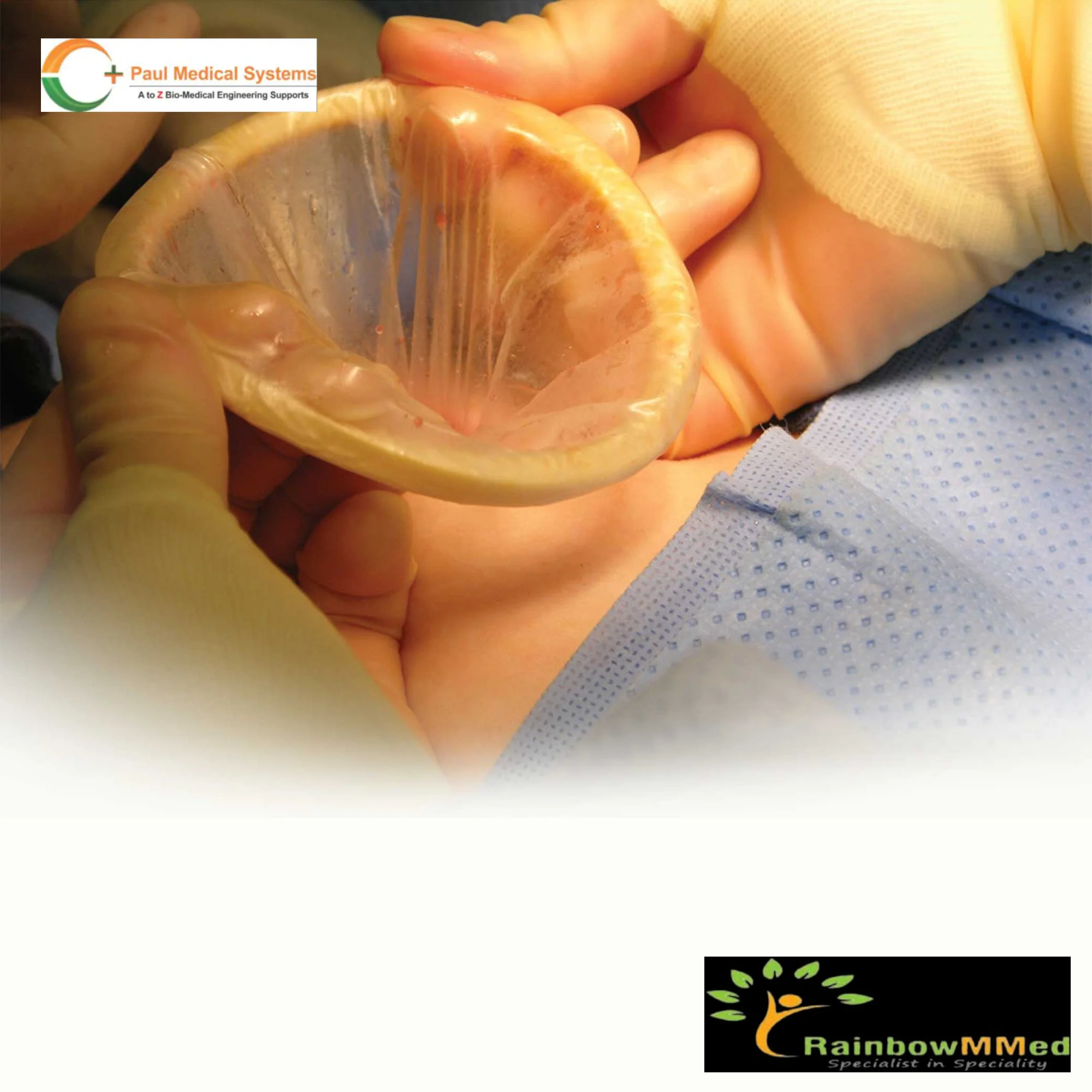 Mobius Retractor Mobius Csection Abdominal Surgical Retractor Ob Mobius Csection Csection