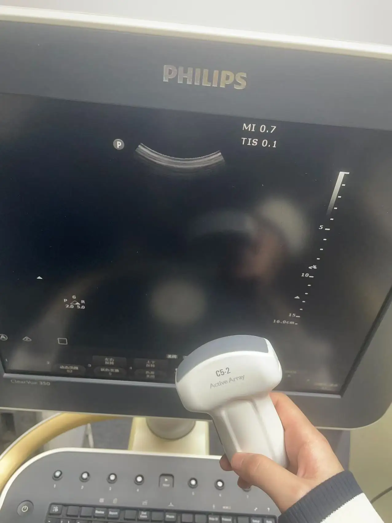 Philips ClearVue 350 Console