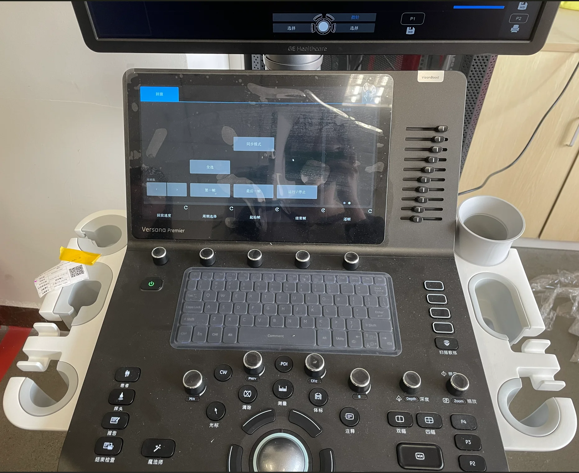 GE Versana Premier Plus Detail 1