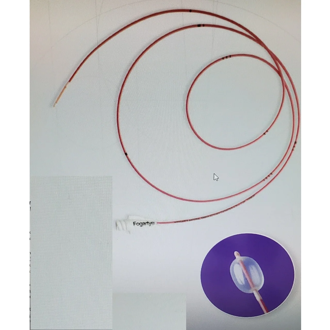 Embolectomy Catheter For Cardiology Straight Single Rubber Fogarty