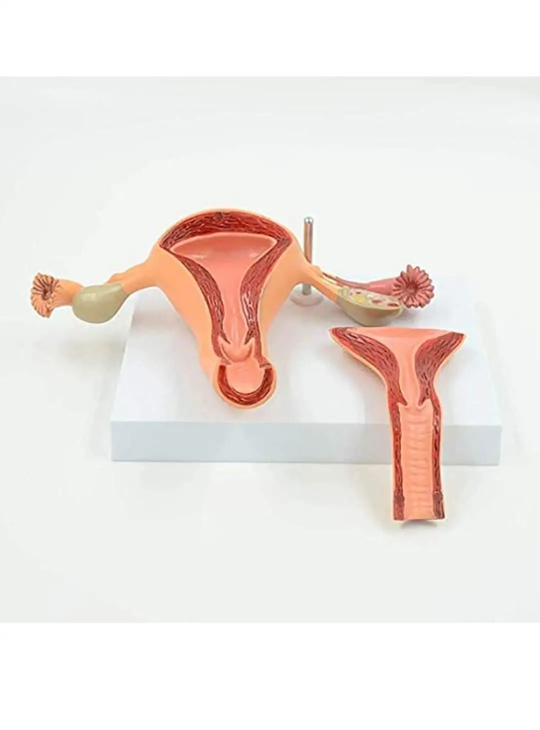 Female Uterus Ovarian Anatomical Models Teaching Structural Anatomy ...