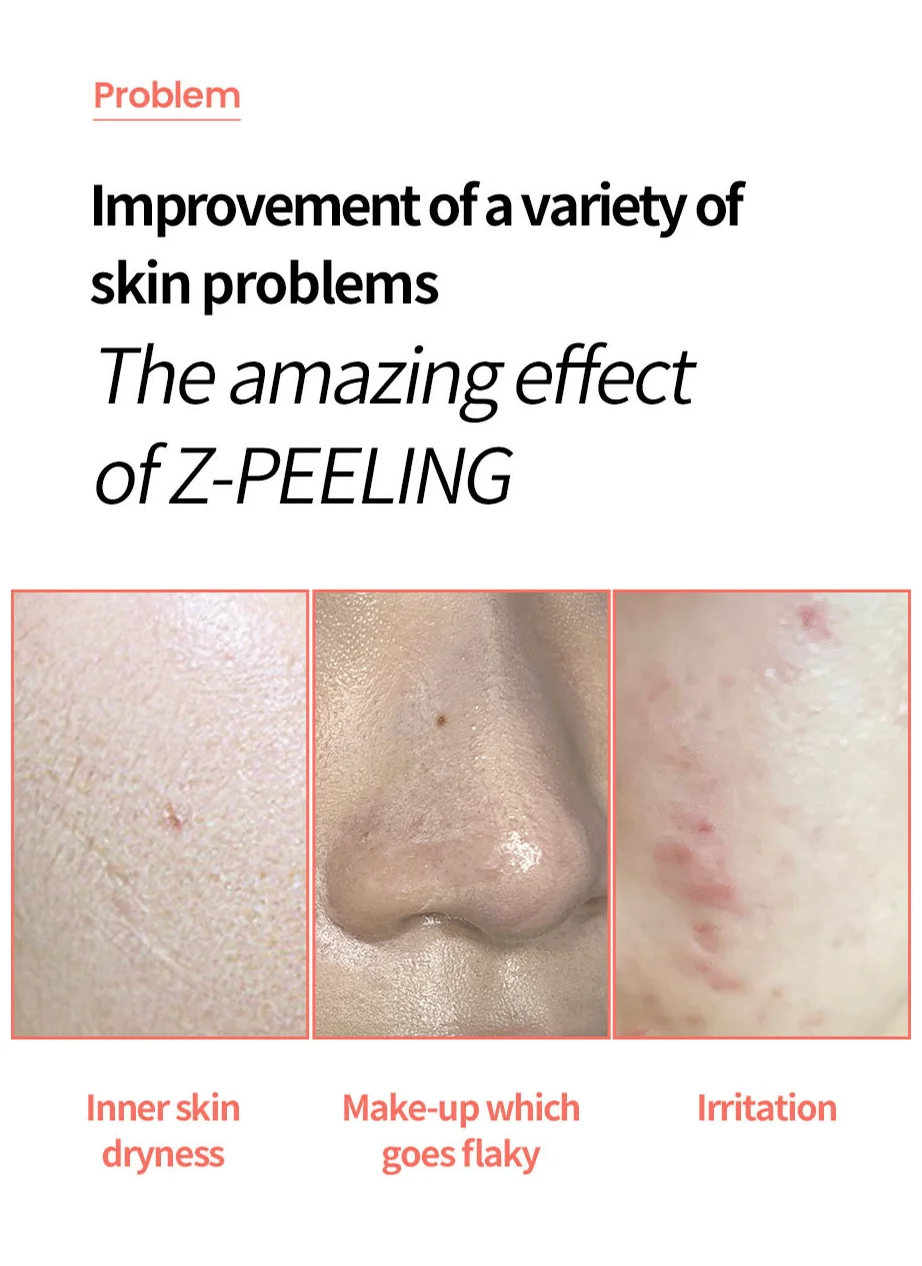 Face Factory Galvanic Z Waterpeeling Machine [made In Korea/beauty