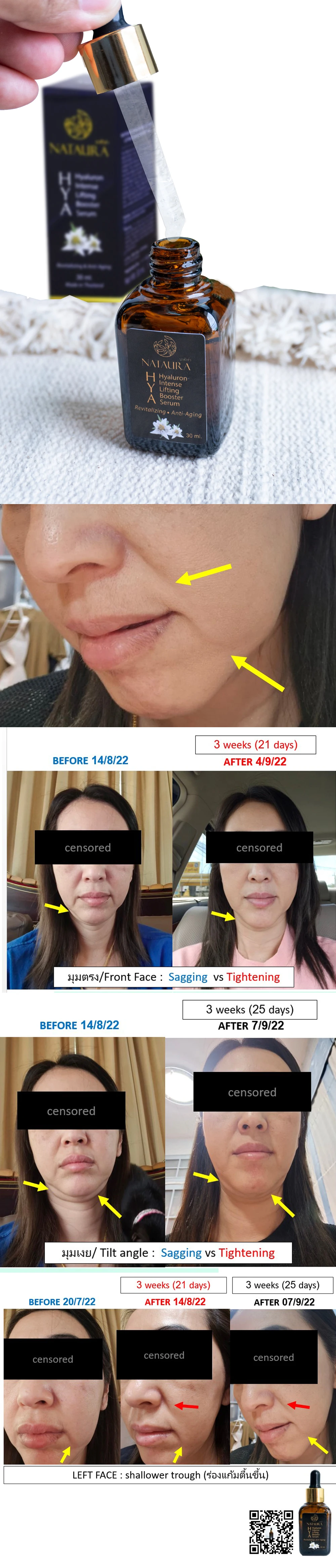 Hot Sale Nataura Hyaluronic Intense Lifting Booster Serum For Nourish