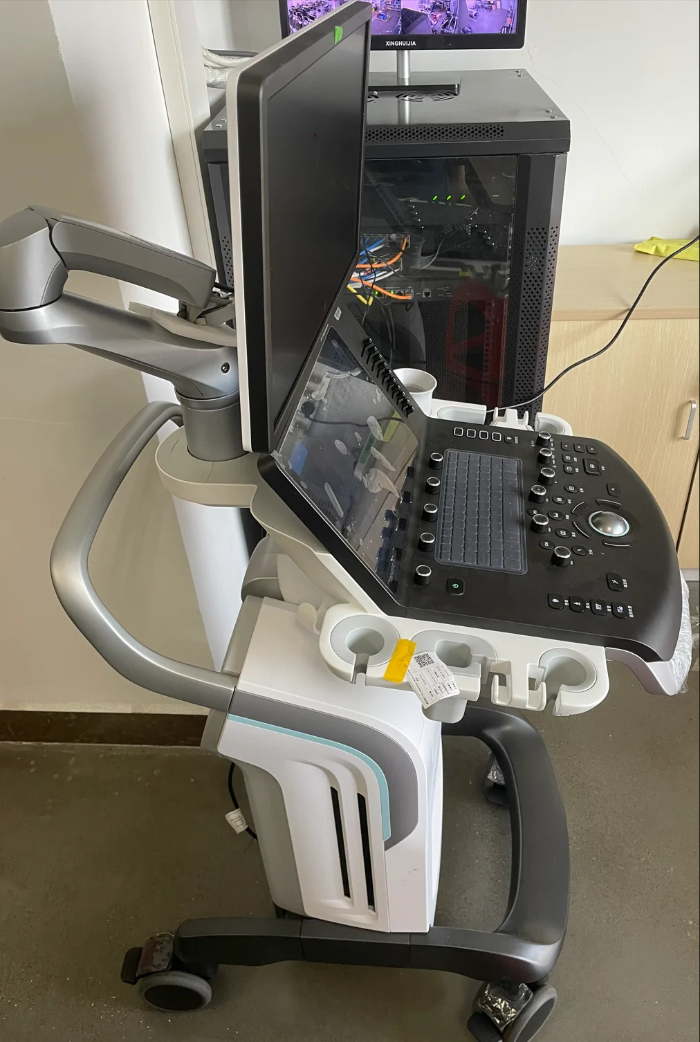 GE Versana Premier Plus Detail 2